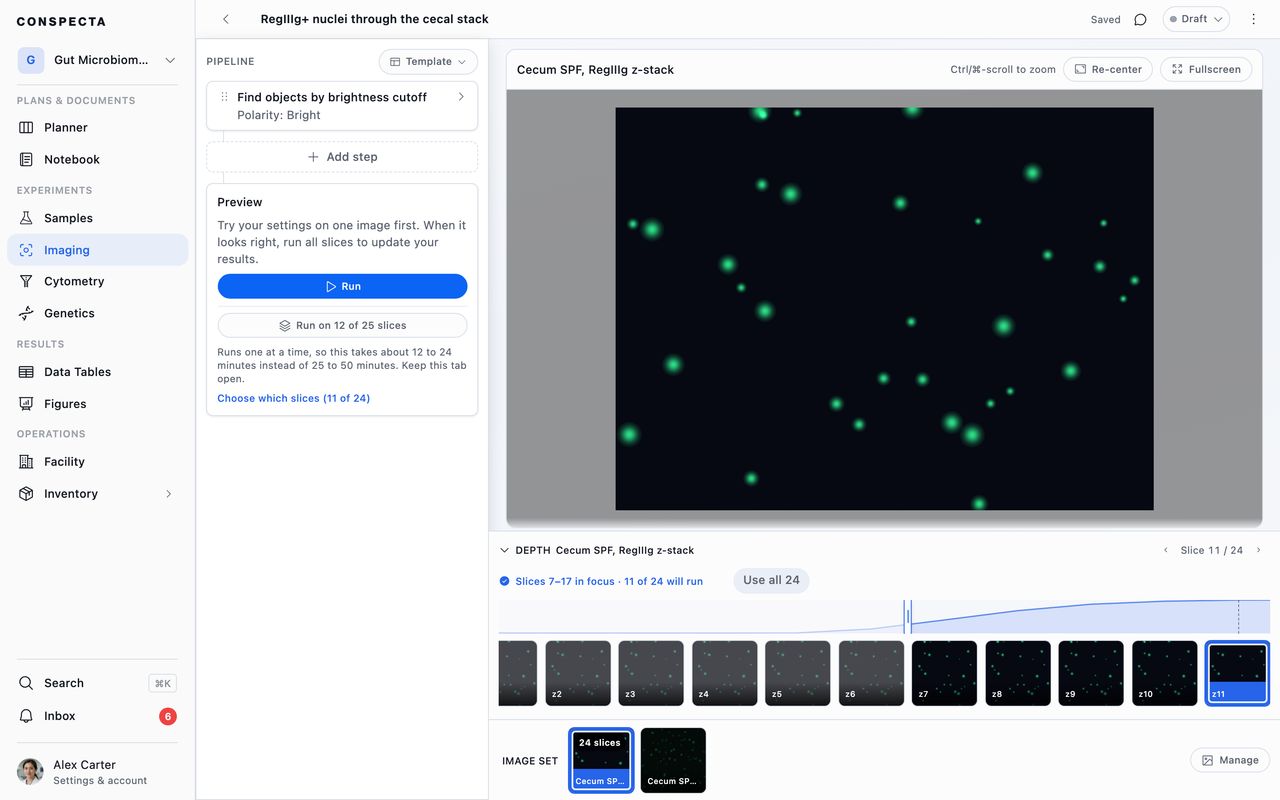 Depth open under a z-stack, reporting the slices in focus and how many of the stack will run, with a thumbnail per slice