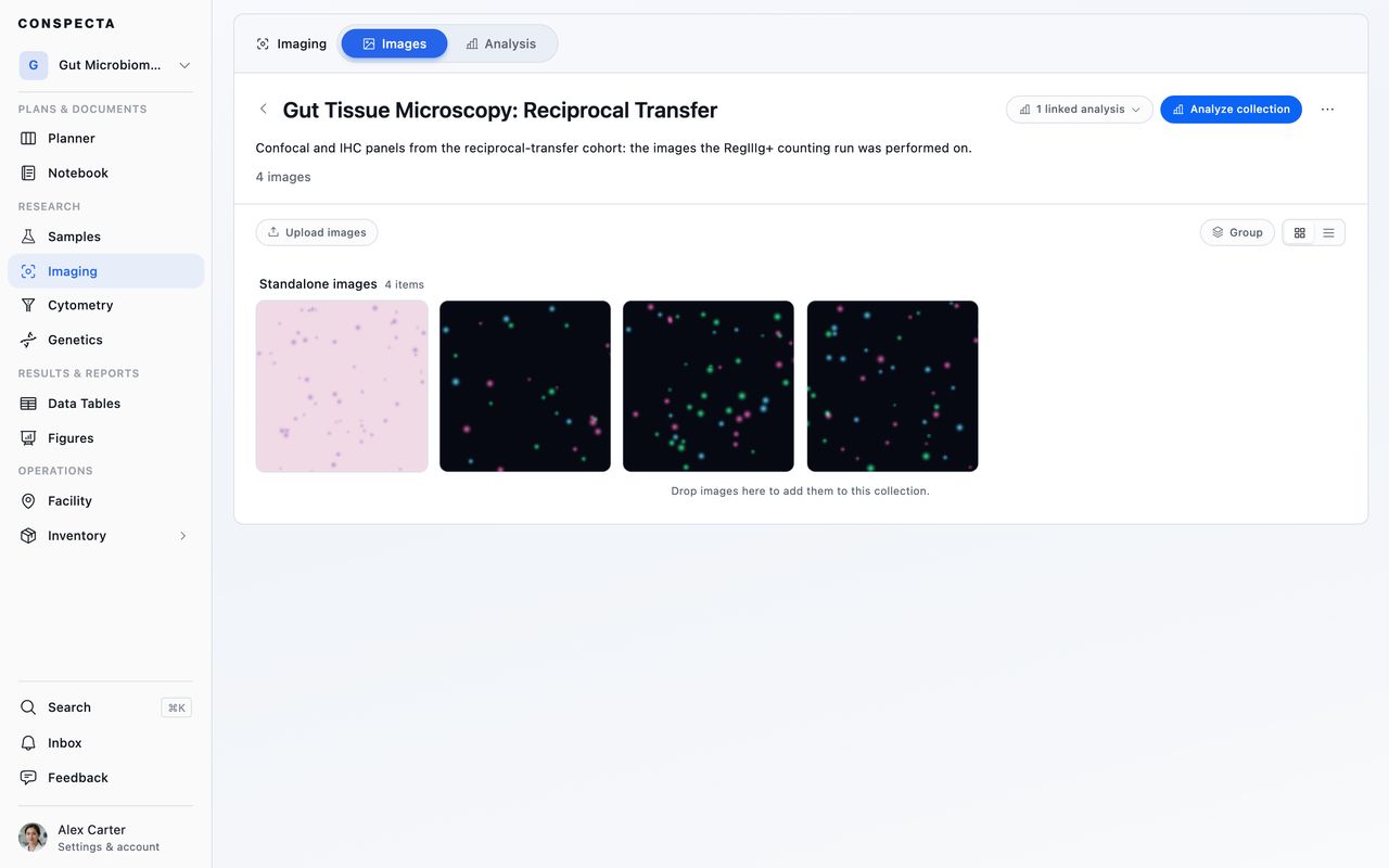 An open collection in the Imaging workspace, with thumbnails of a stained tissue section and three fluorescence images